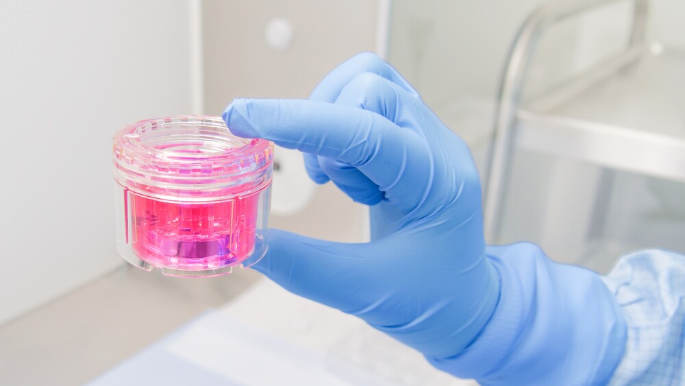 Gewebetransplantat in Nährlösung -Foto: DGFG